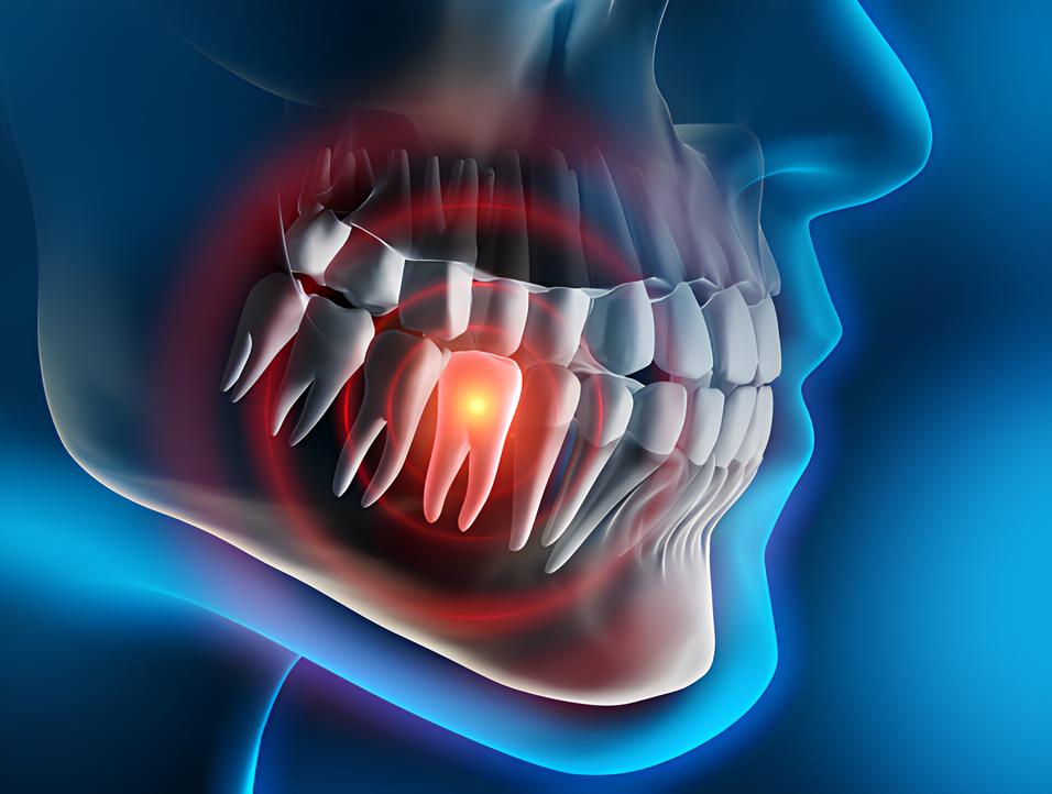 Teeth image - Emergency dentist Gerrards Cross